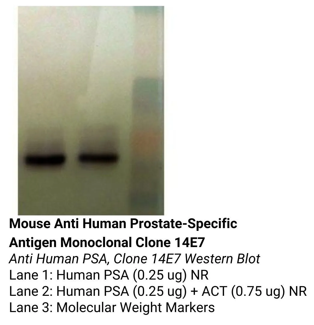 *Mouse Anti Human Prostate-Specific Antigen Monoclonal Clone 14E7